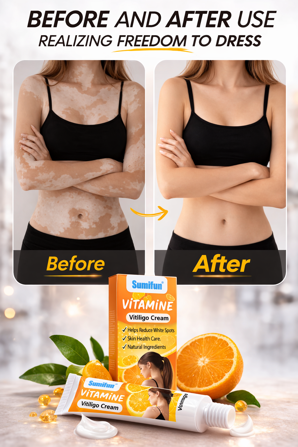 Sumifun - Vitamine Vitiligo Cream