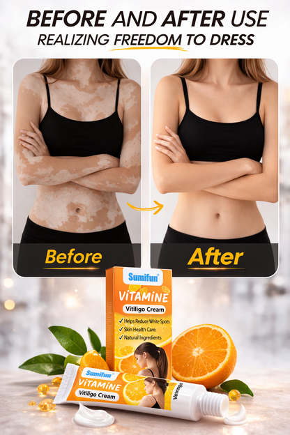 Sumifun - Vitamine Vitiligo Cream