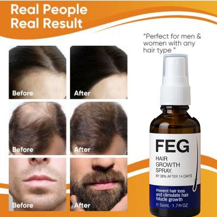 FEG Plus Hair Growth Spray 50ml