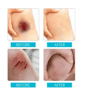 Jaysuing - Liquid Wound Dressing